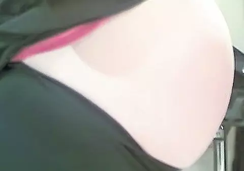 Avea un chist ovarian de 25 de kilograme