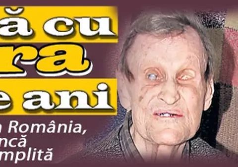 Se luptă de 67 de ani cu lepra