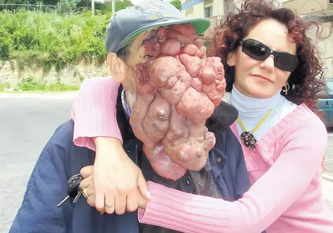 Video / El e omul fără chip