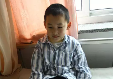 Foto / Un chinez s-a născut cu 31 de degete
