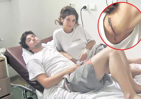 Doi studenţi au supravieţuit după ce au fost fulgeraţi: "Trăsnetul mi-a topit lănţişorul"