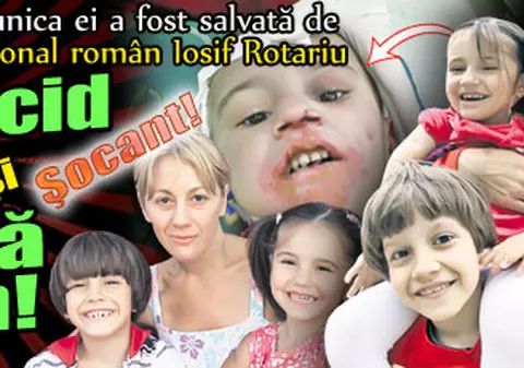 Şocant! Fata adoptată de Rotariu, arsă cu acid sulfuric şi aruncată pe geam!