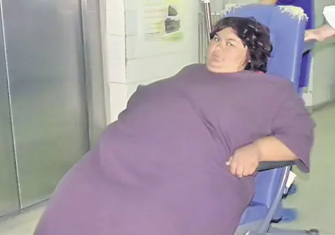 Fiica subnutrită, mama obeză