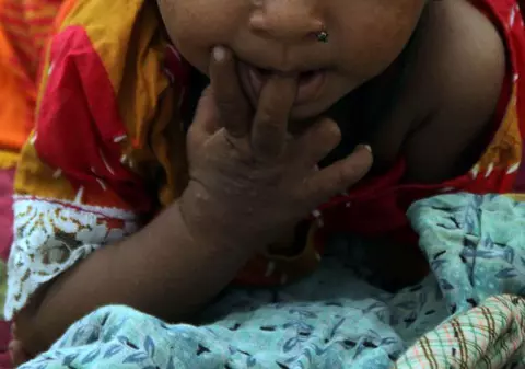 Imaginea zilei | Copiii din Pakistan mor din cauza lipsei apei potabile