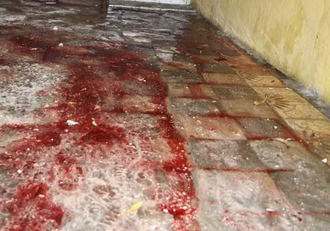 Foto | 15 oameni, ucişi într-un hotel din capitala Somaliei 