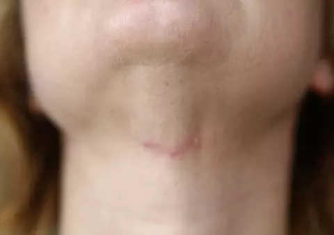 O bucureşteancă îşi acuză medicul estetician: „I-am dat 10.000 de lei şi m-a făcut mai urâtă!” 