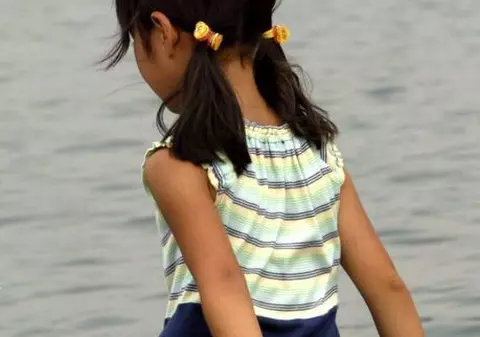 Culoarea pielii unei fetiţe de cinci ani se schimbă de 14 ori pe zi