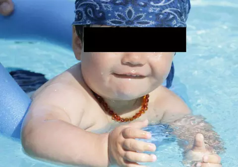 Nu a fost primit la grădiniţă pentru că era prea gras