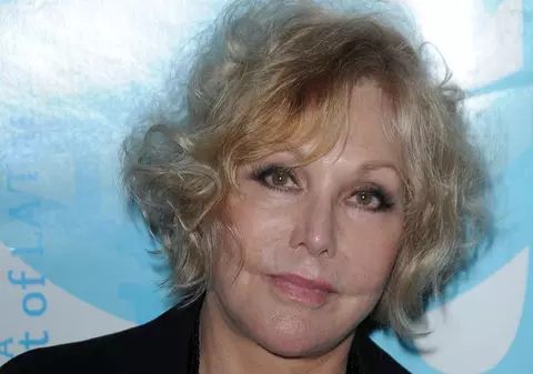 Actriţa Kim Novak a fost diagnosticată cu cancer