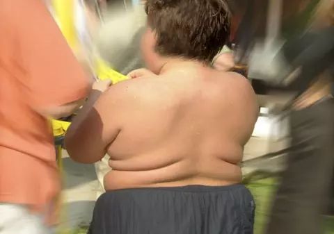 Numărul copiilor preşcolari obezi a crescut cu 60 la sută în ultimii ani