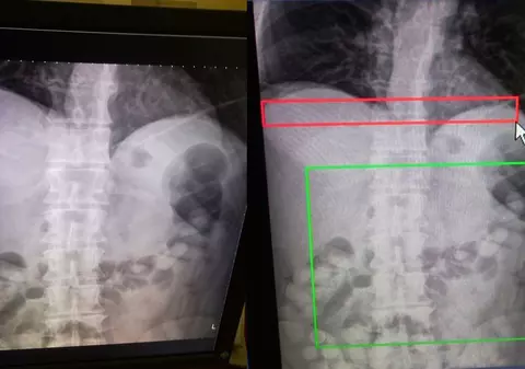 Foto | Un bulgar a fost prins pe Otopeni cu 1 kg de cocaină în stomac