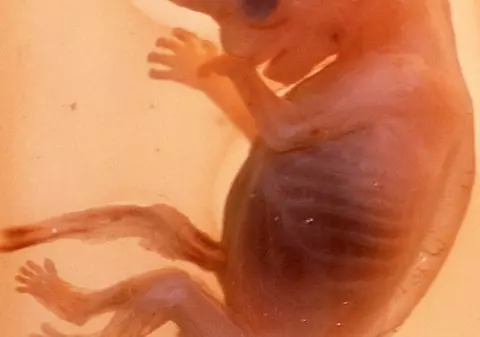 16 lucruri pe care nu le ştiai despre avort