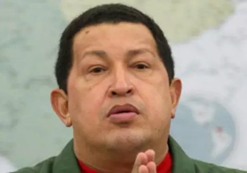 Hugo Chavez, operat de cancer, nu de peritonită
