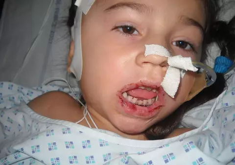 Kassandra, fetiţa fostului fotbalist Iosif Rotariu, operată de 27 de ori!