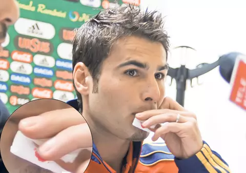 Foto | Adrian Mutu, cu buza spartă!