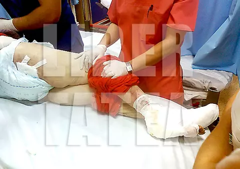 Foto | Șocant! O pacientă a stat în spital până a putrezit carnea pe ea