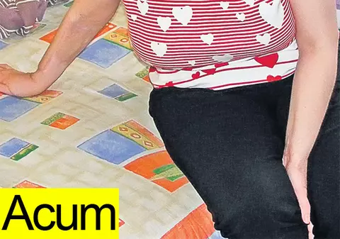 Exclusiv | O femeie din Rădăuţi, arsă cu acid pentru greşeala soţului | Imagini șocante