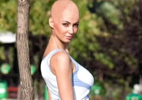 Uite cum ar arăta Nicoleta Luciu cheală!