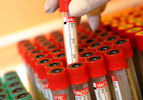 Focare de antrax în Serbia, aproape de graniţa cu România