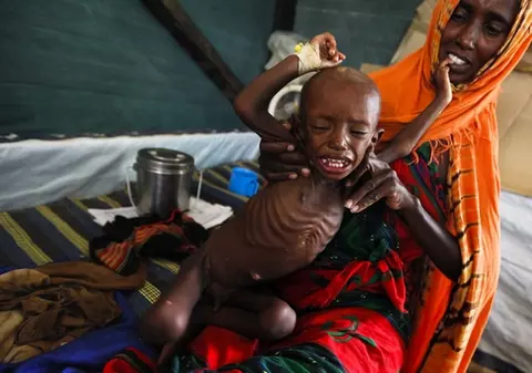 Foto șocant | Așa arată copiii din Somalia! Nu ți se rupe sufletul când îi vezi?