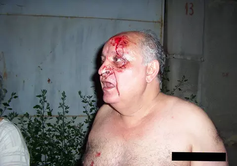 Foto | A vrut să-şi filmeze vecinul şi s-a ales cu mai multe lovituri de lopată în cap! 