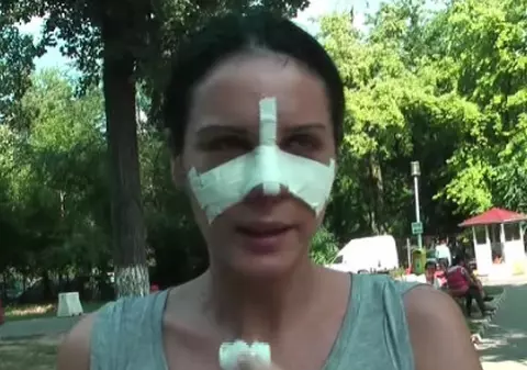 Video | Sosia Adelinei Pestriţu a ieşit la agăţat cu nasul bandajat