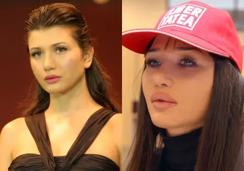 6 vedete înainte şi după mărirea buzelor. Cum arată mai bine?