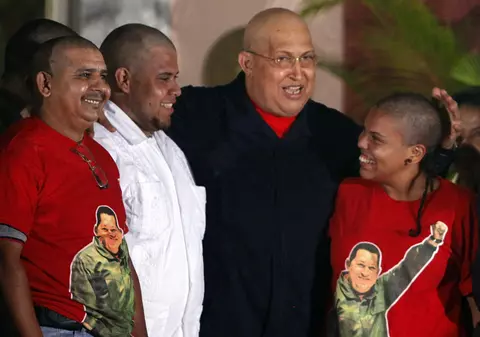 Foto | Venezuelenii care îşi iubesc preşedintele s-au ras în cap pentru el