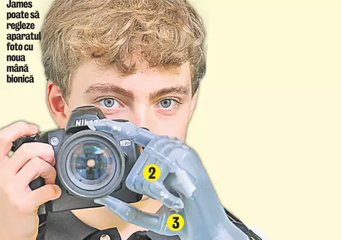 Un adolescent a primit o mână bionică de la Mercedes