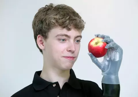 Şefii de la Mercedes i-au făcut cadou unui puşti o mână bionică