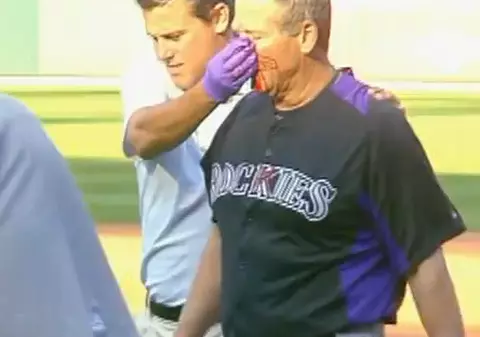 Video | Antrenor de baseball, lovit în faţă de o minge, în direct