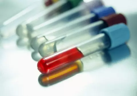 Descoperire istorică: un virus distruge cancerul