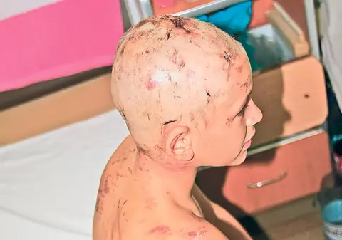 Halucinant! Mâncat de viu de maidanezi! Un copil de 12 ani a fost atacat de o haită furibundă de câini