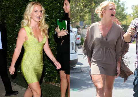 Trucuri de vedetă. Uite cine a slăbit prin liposucţie