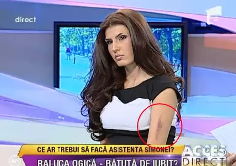 Raluca Ogică, lovită de iubit în parc? "Nu le-am spus părinţilor, mi-a fost ruşine"