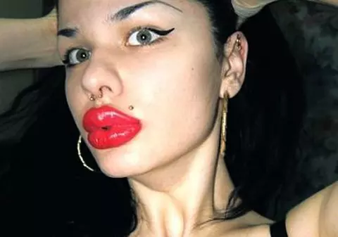 Buzata revine! Uite cum arăta femeia cu gura pe un sfert de față pe vremea când era o fată normală