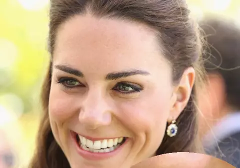 Un dentist francez i-a strâmbat dinţii lui Kate Middleton. Află de ce!