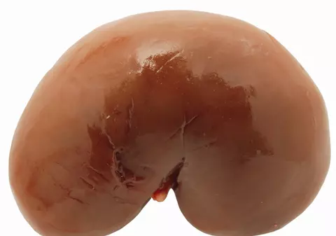 Șocant! Un român vrea să-și vândă un rinichi pentru a-și plăti ratele