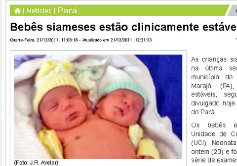 Şocant! Maria din Brazilia a născut un Iisus cu două capete!