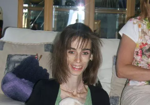 ÎNFIORĂTOR! Femeia de 30 de kilograme a murit! IMAGINI ŞOCANTE