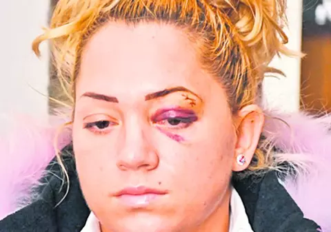 Bete-criţă, Chrissy Givens şi Monique Coker, baschetbaliste la CSM Târgovişte, au bătut crunt o femeie într-un club din Satu Mare
