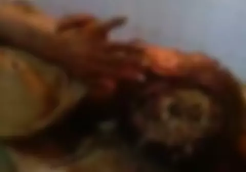 ATENŢIE, IMAGINI ŞOCANTE! Un bărbat are capul plin de viermi! | VIDEO