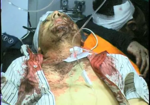 Viceprimar bătut cu bâtele pe stradă