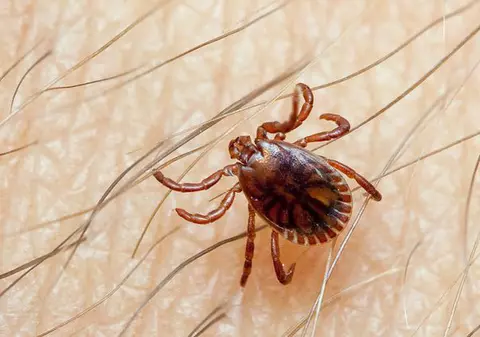 ORIBIL! Două specii de CĂPUŞE trăiesc pe FEŢELE TUTUROR OAMENILOR