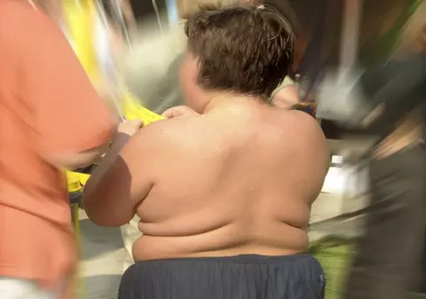 Peste 40% dintre copiii români sunt supraponderali