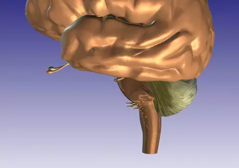 Află care sunt cauzele care îţi încetinesc şi distrug creierul! 