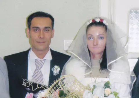 INCREDIBIL! Este iubită de soţ deşi trăieşte cu zeci de bube pe corp 