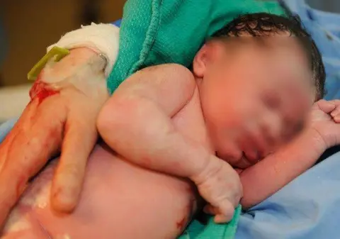 ŞOCANT! Nou-născut, abandonat de mamă pe un câmp