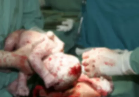 Clipe de GROAZĂ! Bebeluş, DECAPITAT la naştere