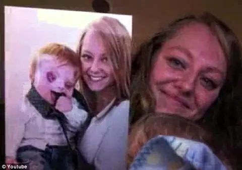 "Copilul-fără-chip" şi drama tulburatoare a unei mame care imploră oamenii să nu mai vadă în fiul ei un MONSTRU | VIDEO